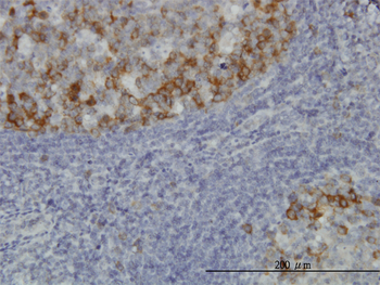 BUB1B monoclonal antibody (M03), clone 3F2