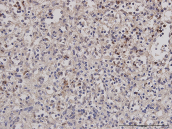 BUB1B monoclonal antibody (M02J), clone 2G5