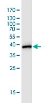 BUB1B monoclonal antibody (M02J), clone 2G5