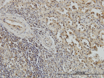 BUB1B monoclonal antibody (M02), clone 2G5