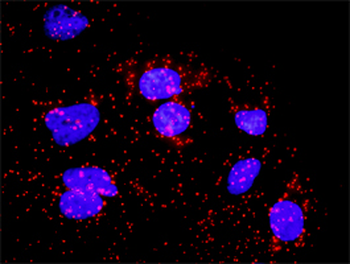 BUB1B monoclonal antibody (M02), clone 2G5