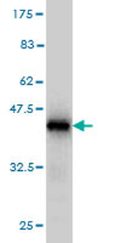 BUB1B monoclonal antibody (M02), clone 2G5