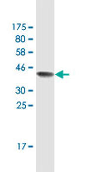 BUB1B monoclonal antibody (M01A), clone 2G9