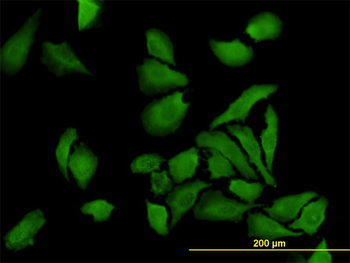 BUB1B monoclonal antibody (M01), clone 2G9