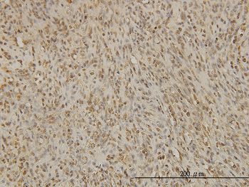 BUB1B monoclonal antibody (M01), clone 2G9