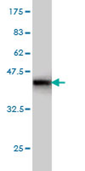 BUB1B monoclonal antibody (M01), clone 2G9