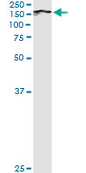 BUB1 monoclonal antibody (M02J), clone 2F9