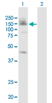 BUB1 monoclonal antibody (M02J), clone 2F9