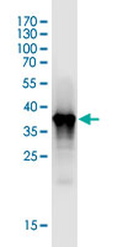 BUB1 monoclonal antibody (M02J), clone 2F9