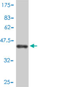 BTF3 monoclonal antibody (M01), clone 3C4-2E11