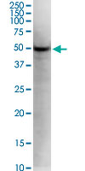 KLF5 monoclonal antibody (M01), clone 2G12