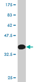 KLF5 monoclonal antibody (M01), clone 2G12