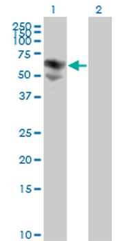 BTD monoclonal antibody (M01), clone 3B10-2B3