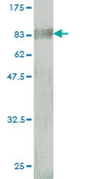 BTD monoclonal antibody (M01), clone 3B10-2B3