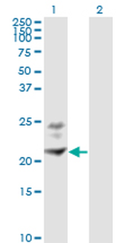 BST2 monoclonal antibody (M02), clone 3H4