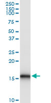 BST2 MaxPab rabbit polyclonal antibody (D02)