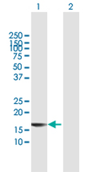 BST2 MaxPab rabbit polyclonal antibody (D02)
