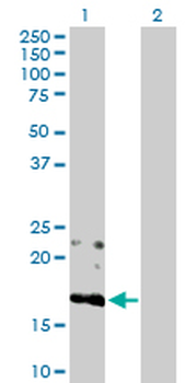 BST2 purified MaxPab rabbit polyclonal antibody (D01P)