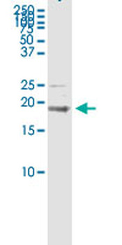 BST2 MaxPab rabbit polyclonal antibody (D01)
