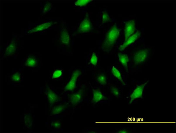 BST2 purified MaxPab mouse polyclonal antibody (B02P)