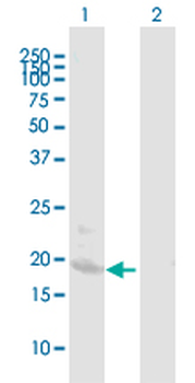 BST2 purified MaxPab mouse polyclonal antibody (B02P)