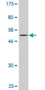 BST1 monoclonal antibody (M08), clone 4C2