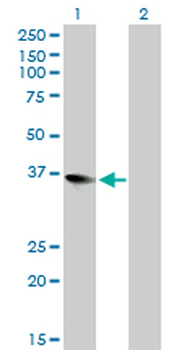 ZFP36L1 monoclonal antibody (M02), clone 1A3