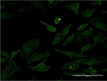 BRAF monoclonal antibody (M04), clone 2F7