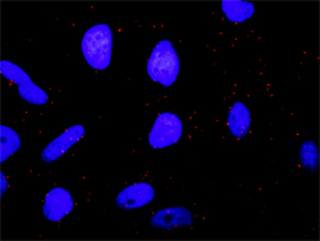 BRAF monoclonal antibody (M02), clone 3D2