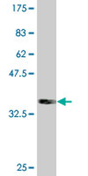 BRAF monoclonal antibody (M02), clone 3D2