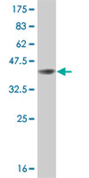 BRAF monoclonal antibody (M01), clone 3C6