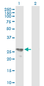 BPHL purified MaxPab mouse polyclonal antibody (B01P)