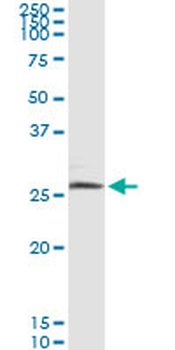 BNIP3L monoclonal antibody (M02), clone 2E11