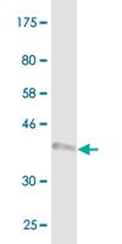 BNIP3L monoclonal antibody (M02), clone 2E11