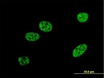 BNIP3L monoclonal antibody (M01), clone 3G2