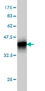 BNIP3L monoclonal antibody (M01), clone 3G2
