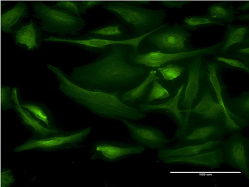 BNIP1 monoclonal antibody (M01), clone 1G7