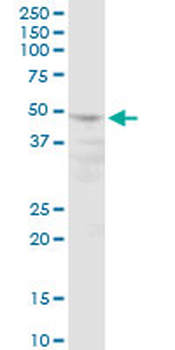 POLR3D purified MaxPab mouse polyclonal antibody (B01P)