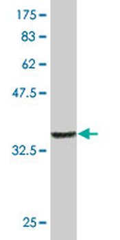 BMX monoclonal antibody (M01), clone 3G3