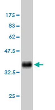 BMPR1B monoclonal antibody (M02), clone 3A8
