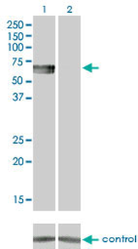 BMPR1B monoclonal antibody (M01), clone 2F3