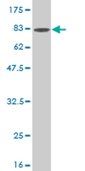 BMPR1B monoclonal antibody (M01), clone 2F3