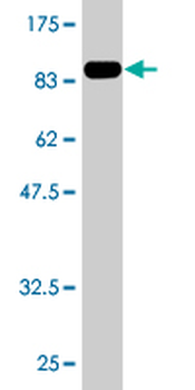 BMPR1A monoclonal antibody (M01), clone 4C4