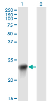 BLVRB monoclonal antibody (M09), clone 2F4