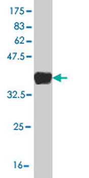BLVRB monoclonal antibody (M09), clone 2F4
