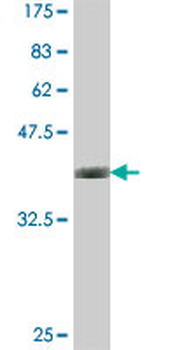 BLVRB polyclonal antibody (A01)