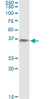 BLVRA monoclonal antibody (M03), clone S2
