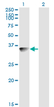 BLVRA monoclonal antibody (M03), clone S2