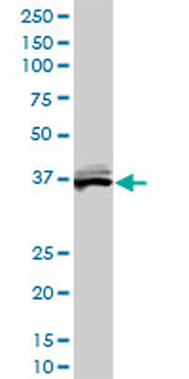 BLVRA monoclonal antibody (M01A), clone S1