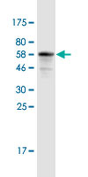 BLVRA monoclonal antibody (M01A), clone S1